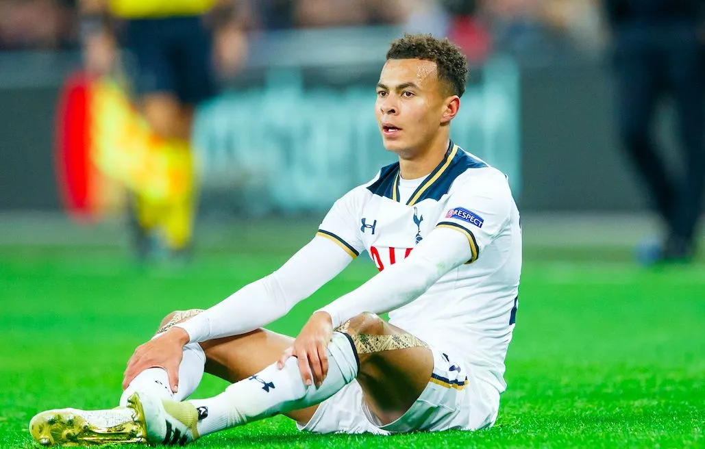 Dele Alli absent contre l&rsquo;Écosse