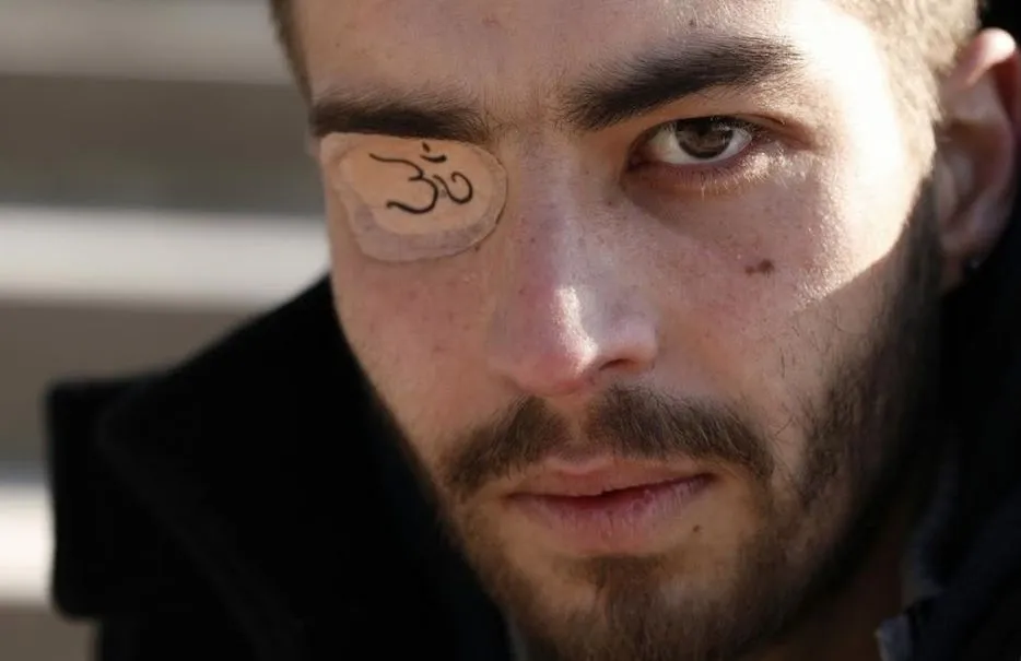 Casti : «<span style="font-size:50%"> </span>Ce qui m’a vraiment fait mal, ce n’est pas d’avoir perdu un œil…<span style="font-size:50%"> </span>»