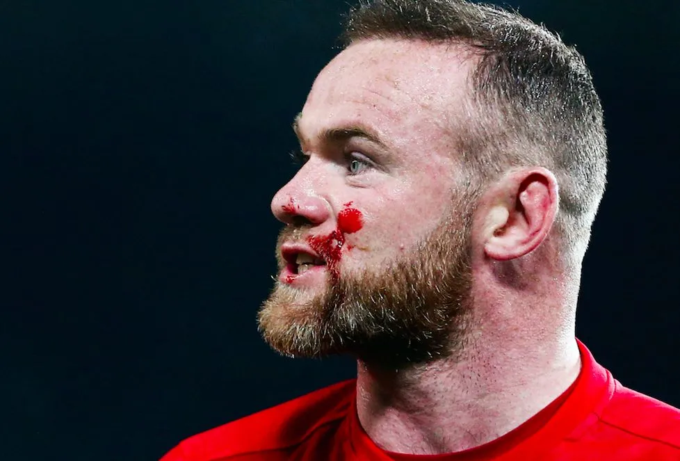 En fait-on trop avec le sang des joueurs ?