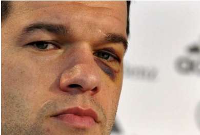 Ballack absent du Mondial ?