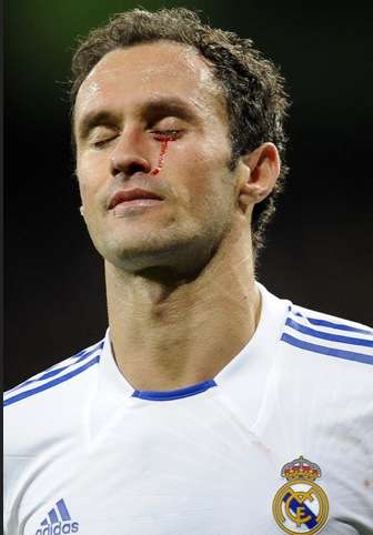 Photo: Carvalho pleure du sang