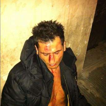 Photo : Mutu explose un serveur