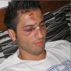 Photo : Mutu explose un serveur, bis