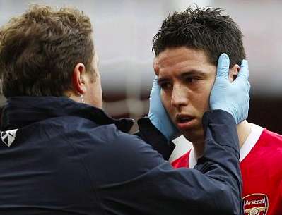 Photo: la bosse de Nasri