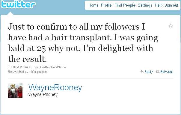 Twitter : Les implants de Rooney