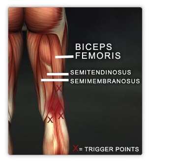 Le mystérieux mal du Barça