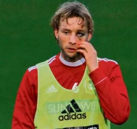 Photo: la bosse de Rolfes a évolué