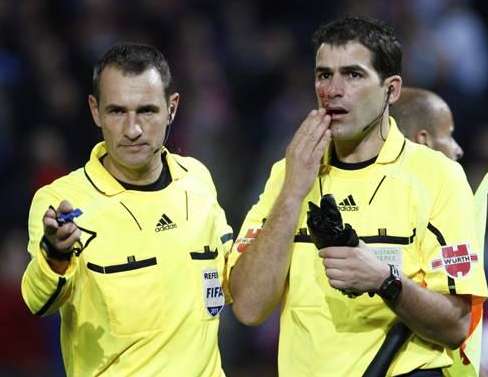 Il reçoit un parapluie en pleine face