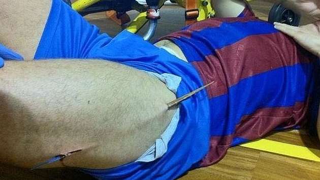 Photo: une sacrée épine dans la jambe