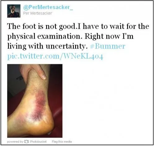 Photo : Mertesacker a pris cher