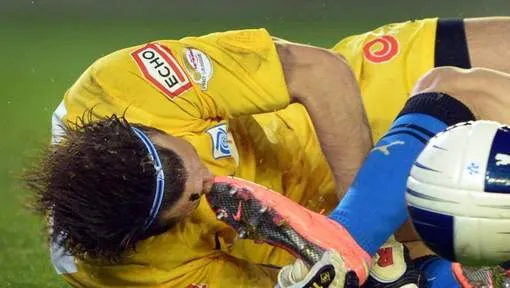 Photo : L’accident de Bailly