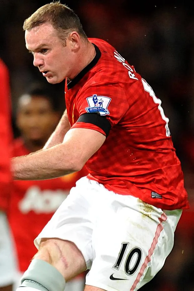Photo : La cicatrice de Rooney