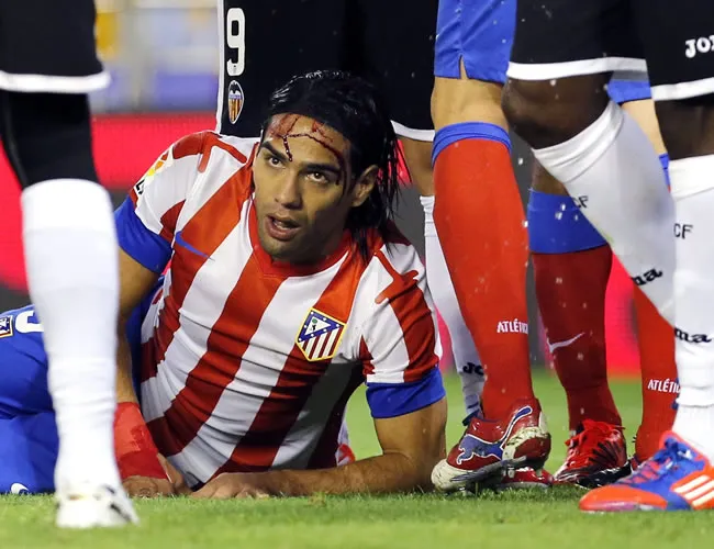Photo: Falcao ensanglanté