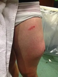 Photo : Une jambe difforme !