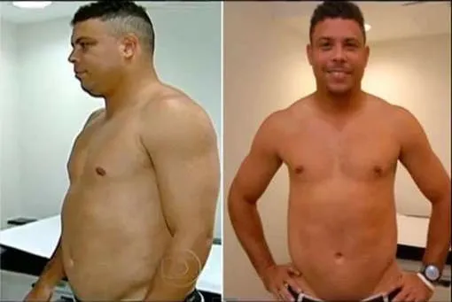 Photo : Ronaldo a perdu 20 kilos !