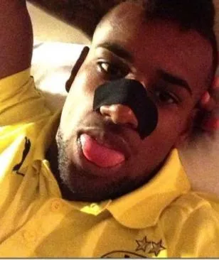 Photo: Le nez cassé de Santana