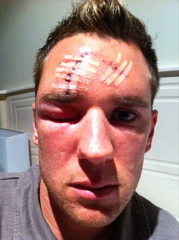 Photo : Les ravages des crampons