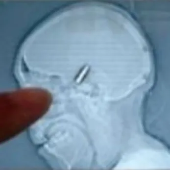 Photo : Il joue avec une balle dans le crâne