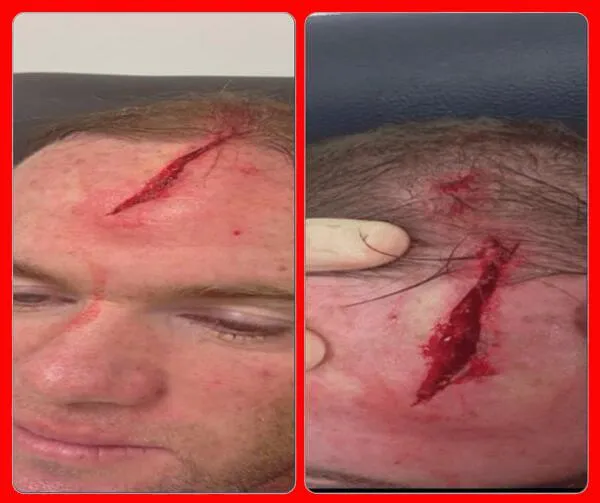 Photo : Rooney s’est fendu la gueule