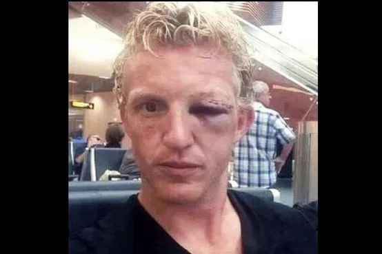 Photo : Kuyt défiguré