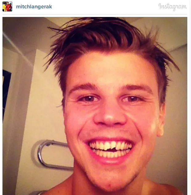 Photo : Les dents contre le poteau