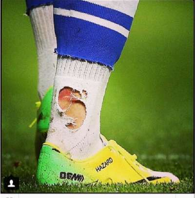 Photo : La chaussette dévorée d’Hazard