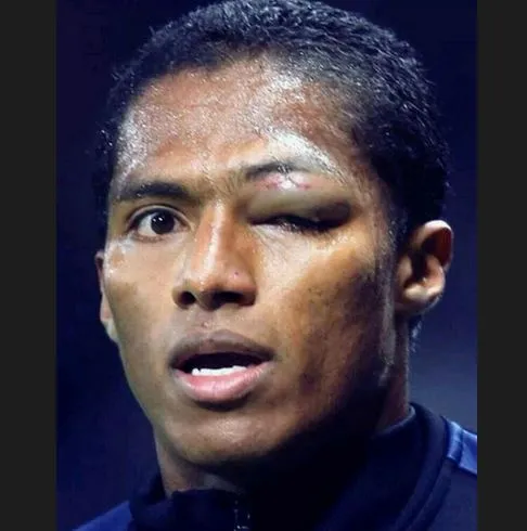 Photo: Valencia défiguré