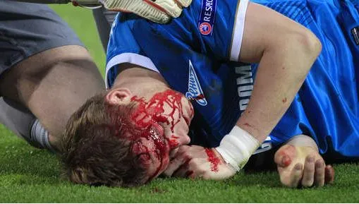 Photo : Le coup de genou de Lewandowski