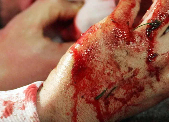 Un Tunisien blessé par une pierre