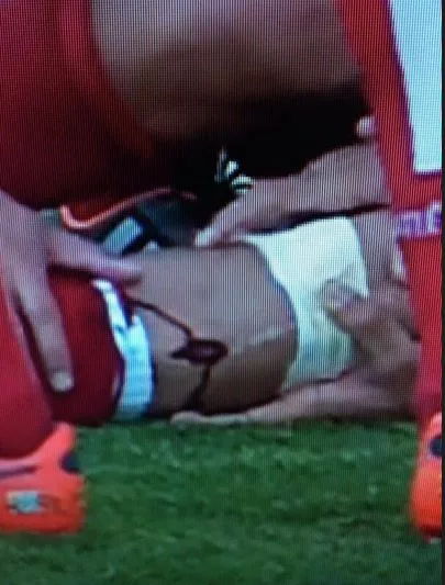 Photo : Le tibia troué de D.Costa