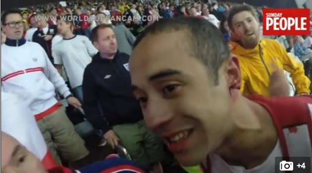 Photo : Un Anglais se fait croquer l&rsquo;oreille