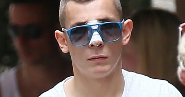 Photo : Le nouveau nez de Lucas Digne