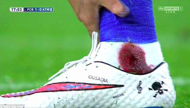 La cheville ensanglantée de Neymar