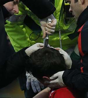 Paddy McNair et l&rsquo;agrafeuse