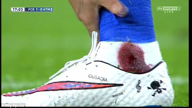 La cheville ensanglantée de Neymar