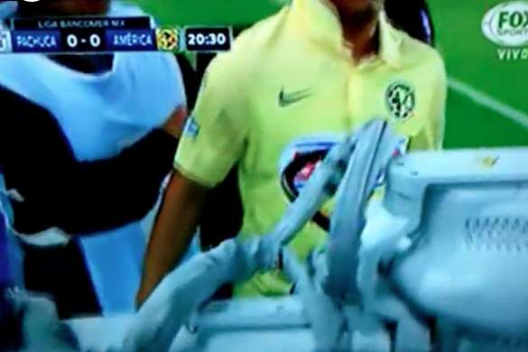 Vine : Un scanner réalisé sur le côté du terrain