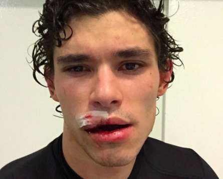 Photo : Dodô a pris cher