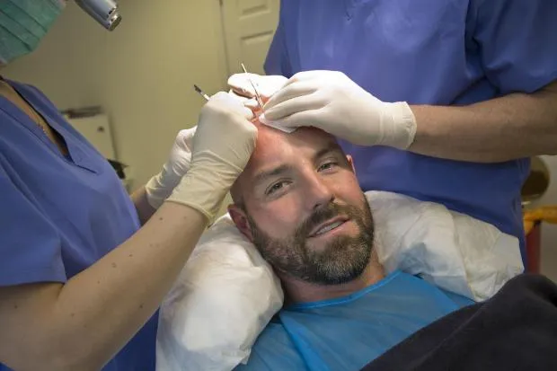 Greffe de cheveux pour Kris Boyd