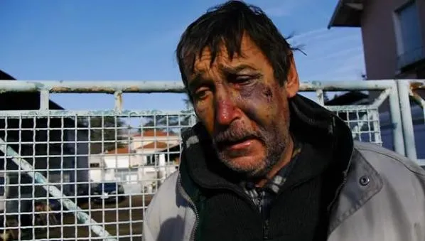 Vidéo : L’opposant au Grand Stade de Lyon violemment tabassé