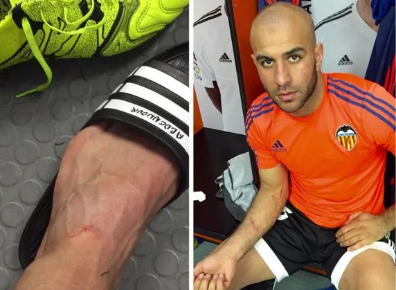 Photo : Abdennour montre les traces de son duel avec Suárez