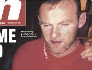 Wayne Rooney soigne sa blessure d&rsquo;une drôle de façon