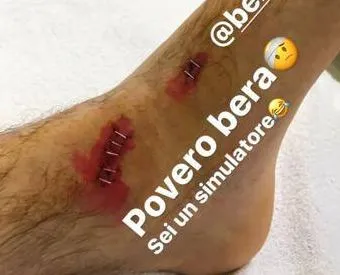 Berardi blessé, Cannavaro le chambre