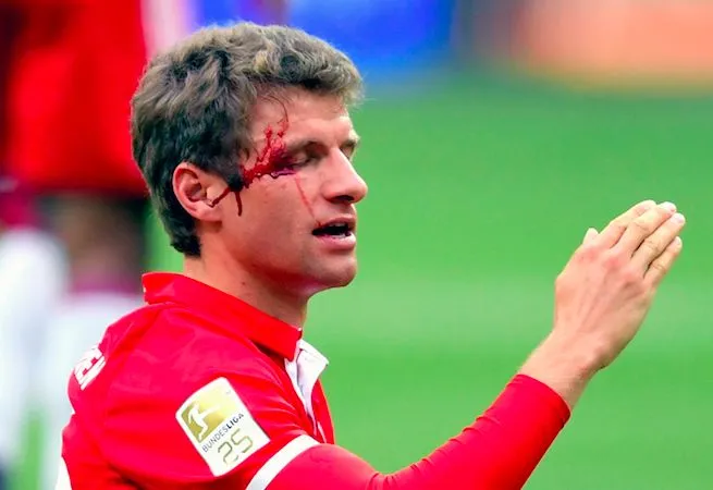 En fait-on trop avec le sang des joueurs ?